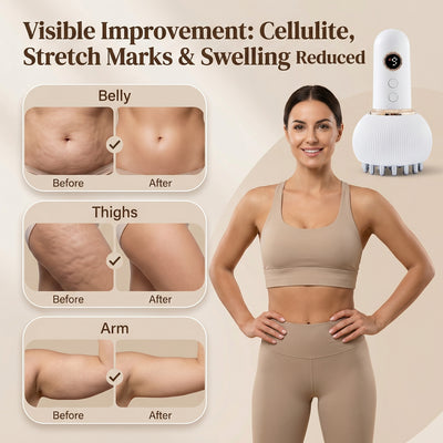 The LymphLift™ Sculptor